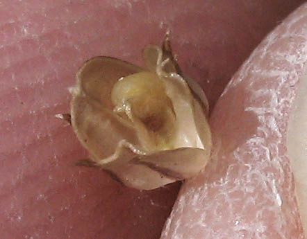 Detailed Picture 12 of Bridges' Pincushionplant